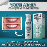 1 + 1 GRATIS |  White Again™ - Blanqueador